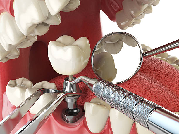 Best Weekend Emergency Dentist in Burke, VA