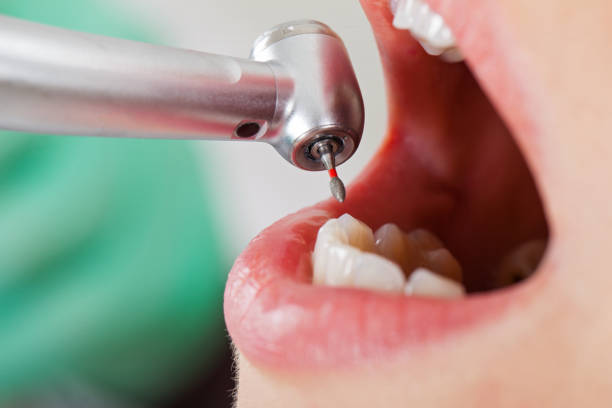 Best Emergency Treatment for Toothache in Burke, VA